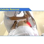 Endosphères-Roller-Massagegerät gegen Cellulite