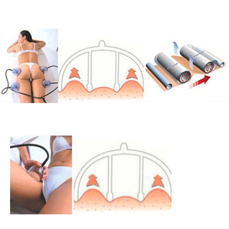 Starvac Sp2 Vakuumtherapie Massage Schröpftherapie Massager Körperstraffung Vakuum Tasse Maschine